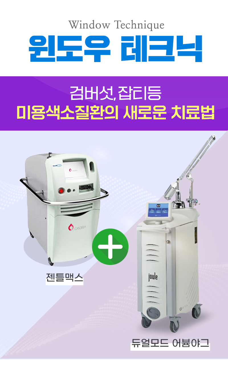 윈도우 테크닉