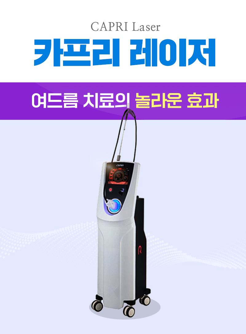 카프리레이저